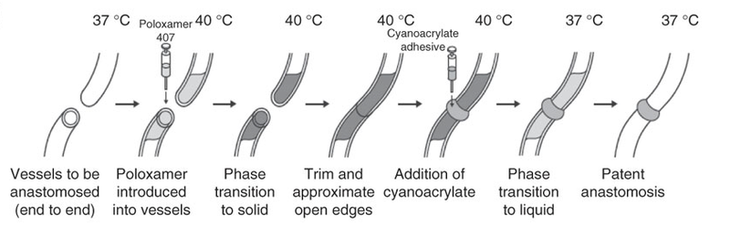 Illustration for article titled Now we can join blood vessels together without stitches